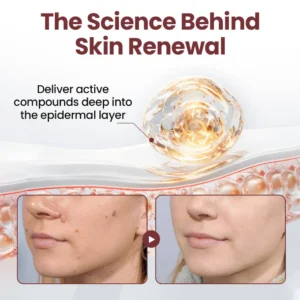 Lovilds®KeraErase Dual-Action Renewal Cream