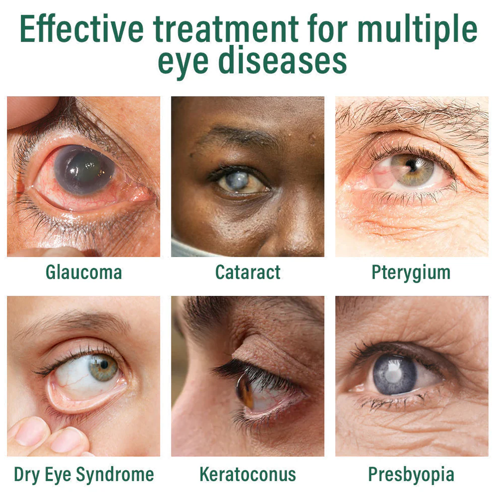 LOVILDS™Nano Eye Drops Serum LOVILDS™Nano Eye Drops Serum