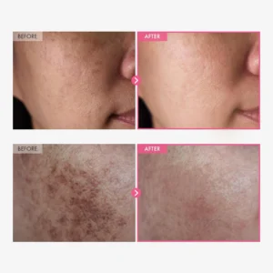 LOVILDS™ Dark Spot Fade Cream