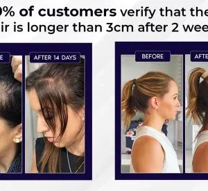 LOVILDS Natural Hair Regrowth Spray