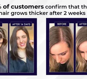 LOVILDS Natural Hair Regrowth Spray