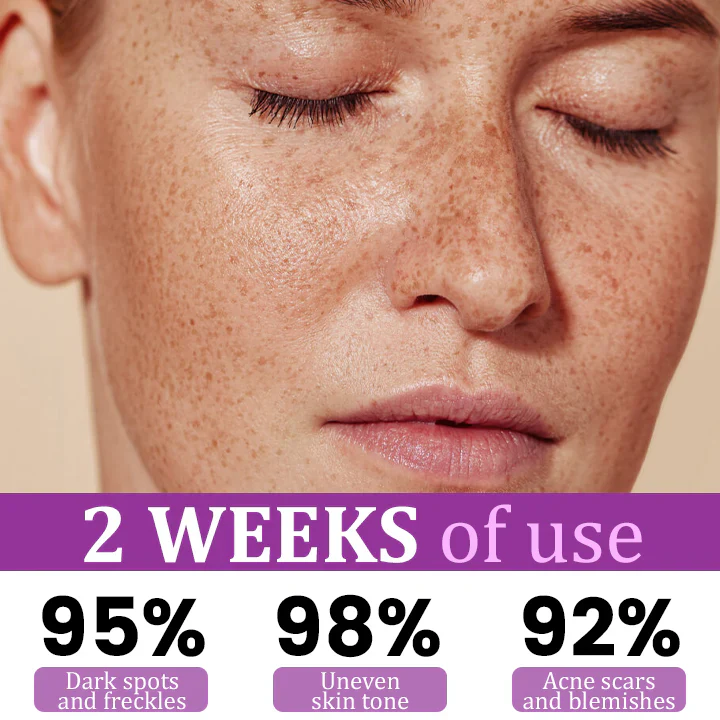 LOVILDS™ MelantraX Advanced Anti-Hyperpigmentation Essence