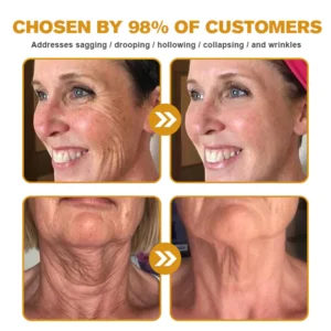 LOVILDS™ Bee Venom Skin Restoration Cream