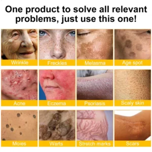 LOVILDS™ Bee Poison Skin Restoration Cream