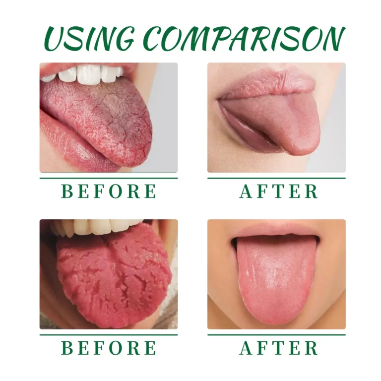 LOVILDS Tongue Repair Spray