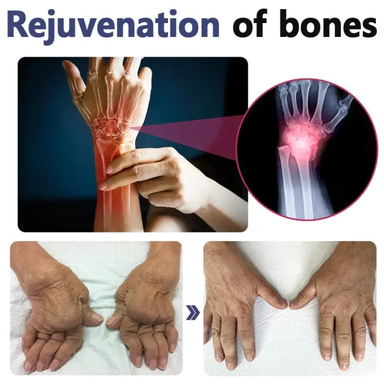 LOVILDS™ Bee Venom Joint and Bone Therapy Advanced Cream
