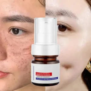 LOVILDS™ WHITENING ANDFRECKLE REMOVING ESSENCE