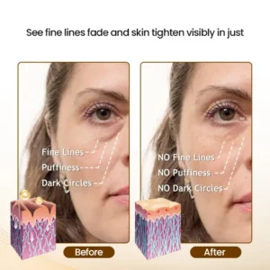 LOVILDS™Skin Firming and Wrinkle Reducing Essence