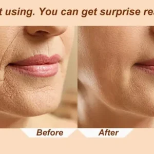 LOVILDS™Electric Facial Massage Roller
