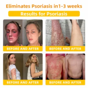 LOVILDS™ Bee Toxin Skin Repair Cream