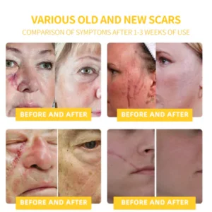 LOVILDS™ Bee Toxin Skin Repair Cream