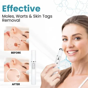 LOVILDS™ Non-Invasive Mole and Wart Removal Laser Pen LOVILDS™ Non-Invasive Mole and Wart Removal Laser Pen