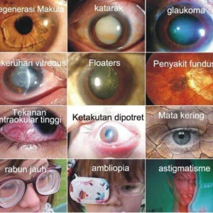 LOVILDS™ Vision Drops — Rapidly Heals All Eye Conditions & Restores Vision
