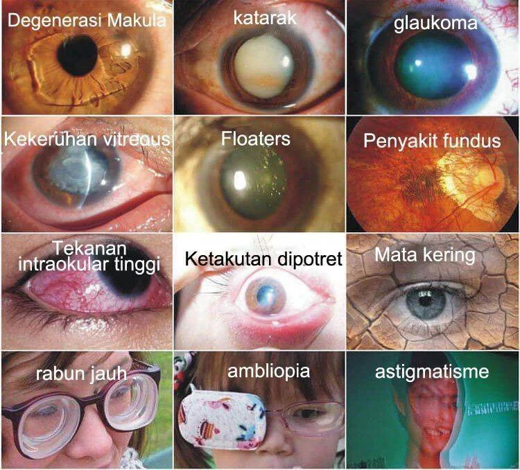 LOVILDS™ Vision Drops — Rapidly Heals All Eye Conditions & Restores Vision