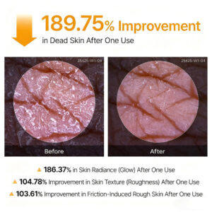 LOVILDS® Peeling Shot Keratin Care Kojic Acid Turmeric Spray