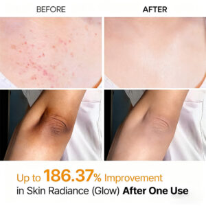 LOVILDS® Peeling Shot Keratin Care Kojic Acid Turmeric Spray