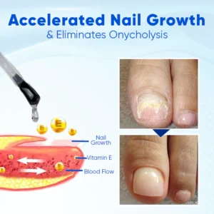 LOVILDS® OnyxoGuard Nail Growth and Repair Serum