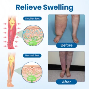 LOVILDS™ Lymphatic Drainage Roll-On Relief Cream