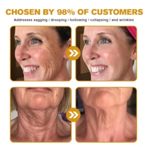 LOVILDS Bee Venom Wrinkle Removal Cream