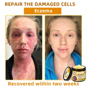 LOVILDS™ Bee Venom Skin Restoration Cream