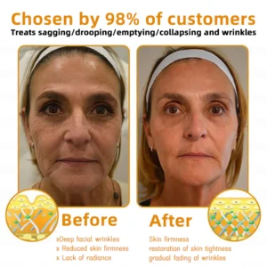 LOVILDS™ Bee Venom Skin Restoration Cream