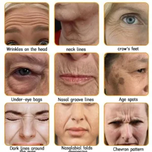 LOVILDS™ Bee Venom Skin Restoration Cream