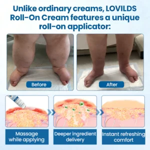 LOVILDS™ Lymphatic Drainage Roll-On Relief Cream