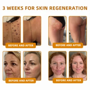 LOVILDS™ Bee Venom Skin Restoration Cream