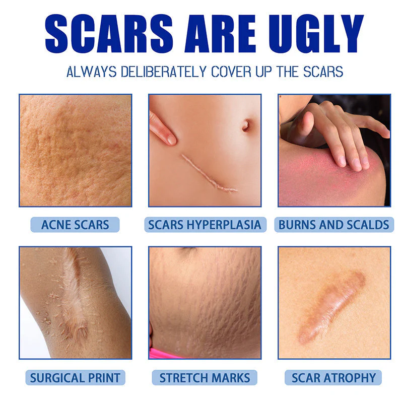 LOVILDS Scar Repair Cream
